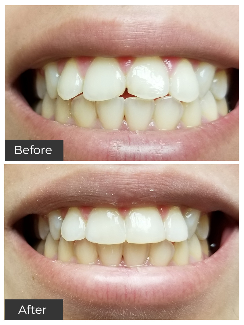 21st Century Dental Care | Teeth Whitening, Root Canal Treatment and Dental Fillings