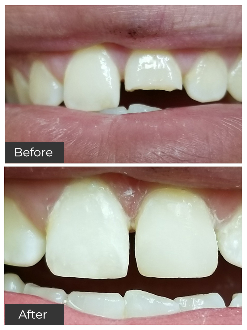 21st Century Dental Care | Preventive Care, Oral Surgery and Root Canal Treatment