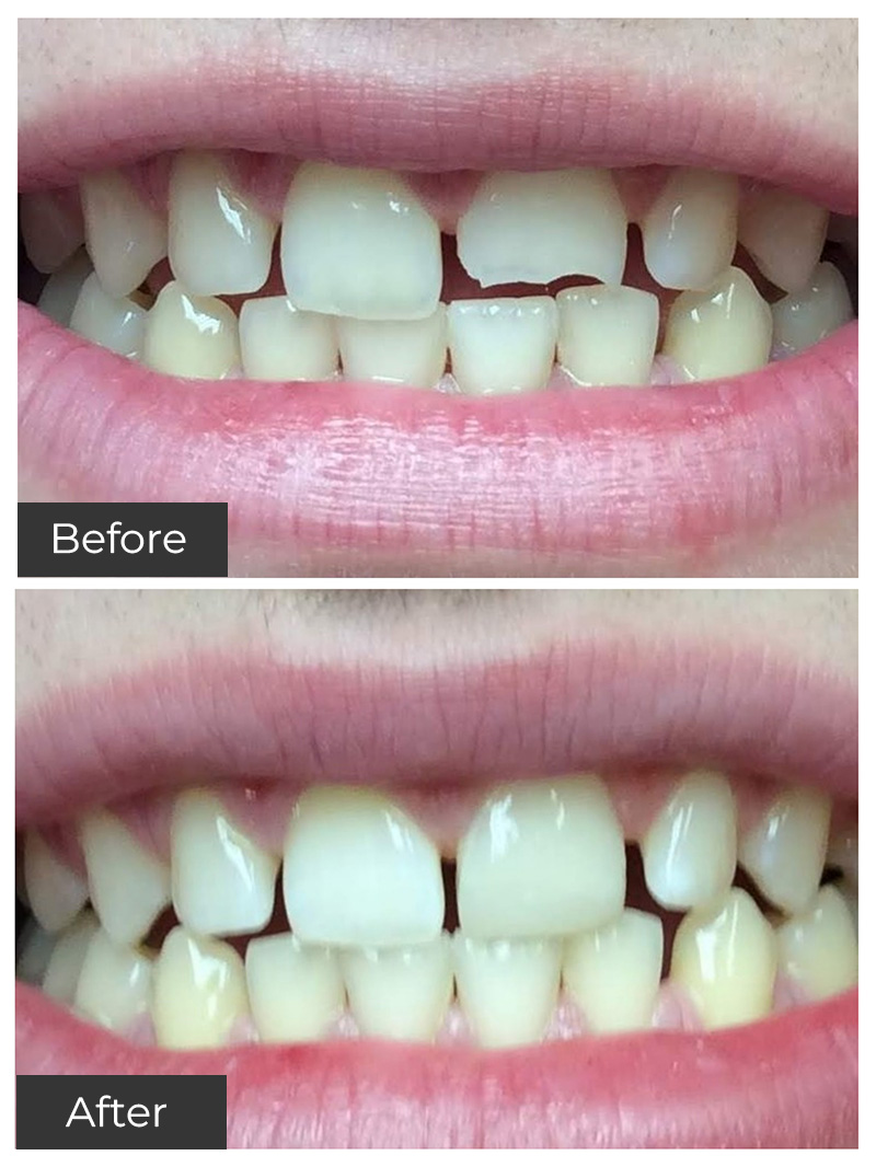 21st Century Dental Care | Dental Implants, Fixed Dental Bridges and TMJ Treatment