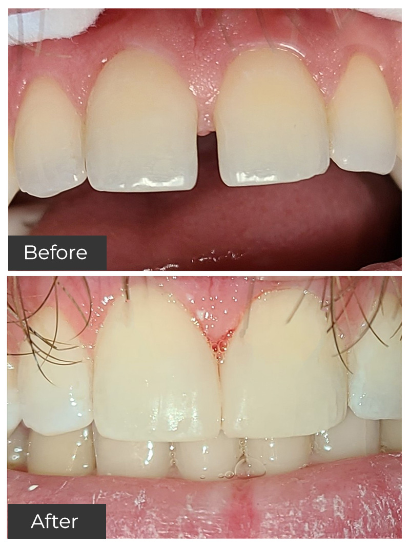 21st Century Dental Care | Oral Surgery, Teeth Whitening and Oral Sedation