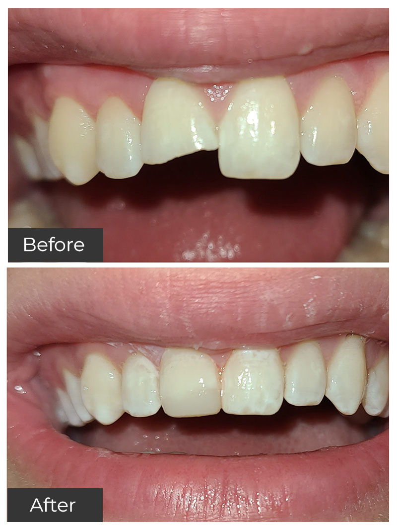 21st Century Dental Care | Invisalign reg , Botox reg  and Oral Surgery