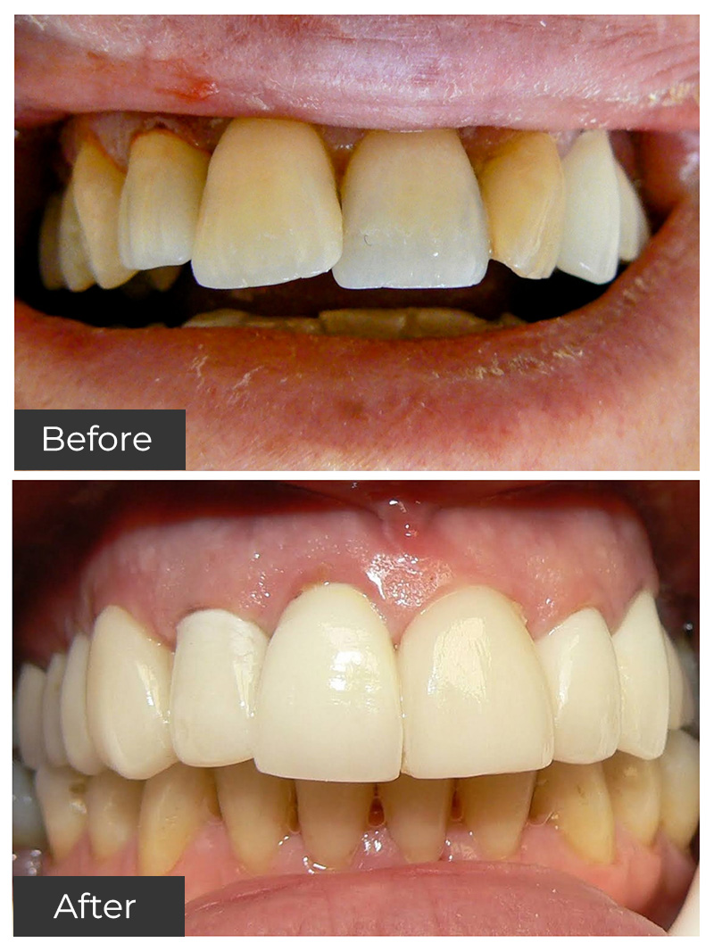 21st Century Dental Care | Preventive Care, Oral Surgery and Root Canal Treatment