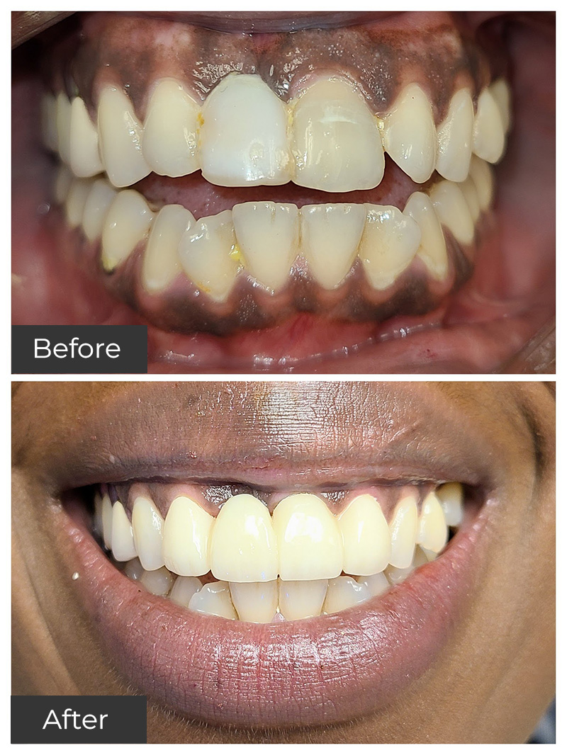 21st Century Dental Care | Dental Implants, Fixed Dental Bridges and TMJ Treatment