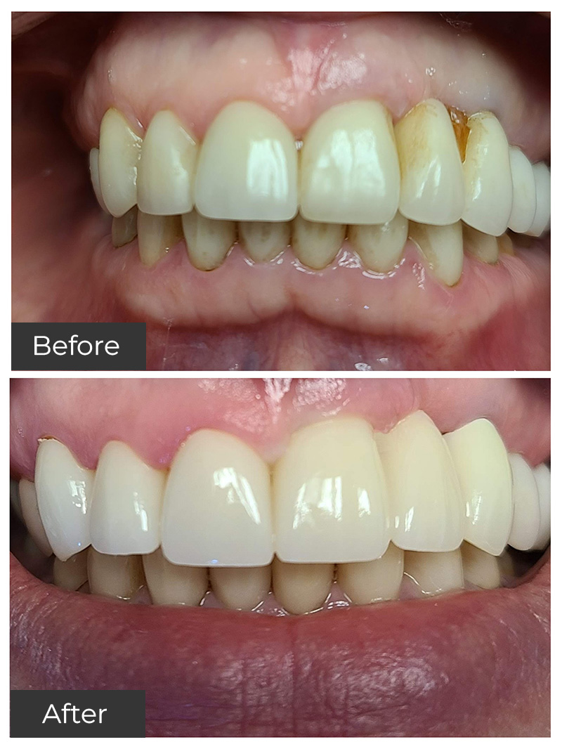 21st Century Dental Care | Oral Surgery, Teeth Whitening and Oral Sedation