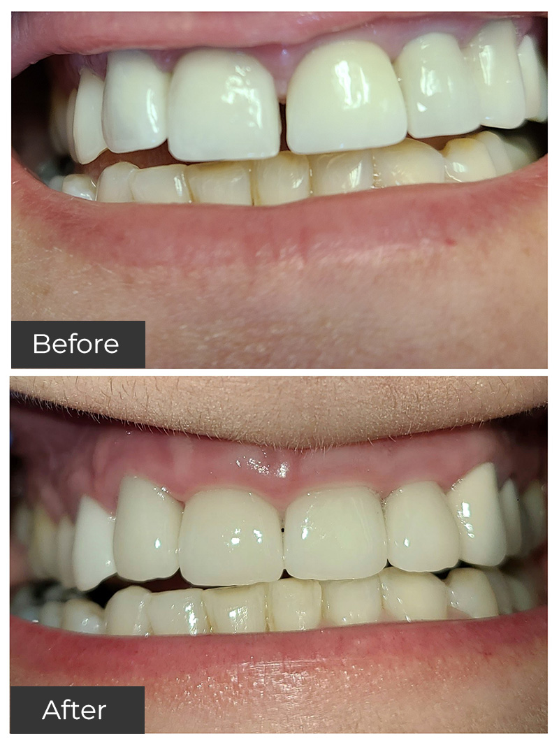 21st Century Dental Care | Porcelain Dental Crowns, Preventive Care and Teeth Whitening