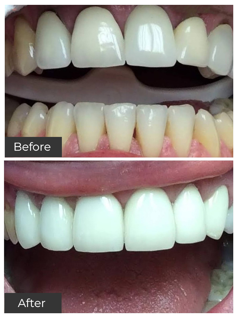 21st Century Dental Care | Invisalign reg , Botox reg  and Oral Surgery