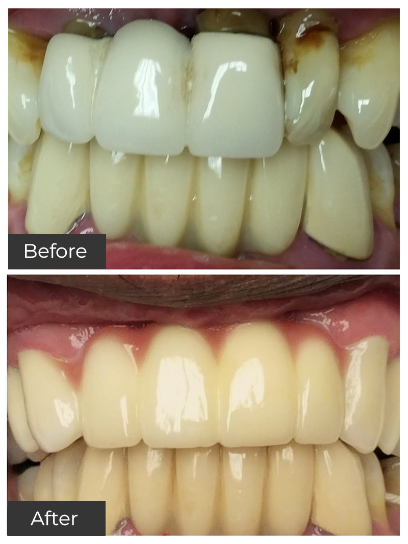 21st Century Dental Care | Oral Sedation, Periodontal Care and Botox reg 