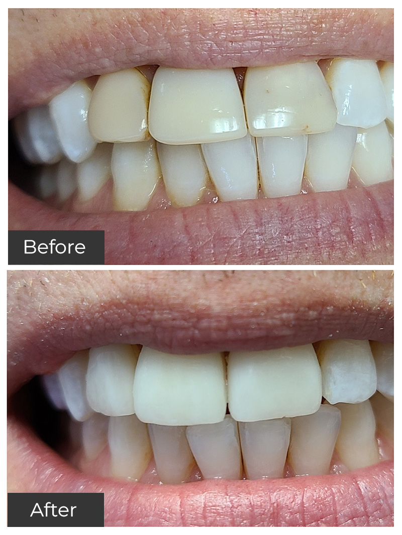 21st Century Dental Care | Teeth Whitening, Juvederm reg  and Periodontal Care