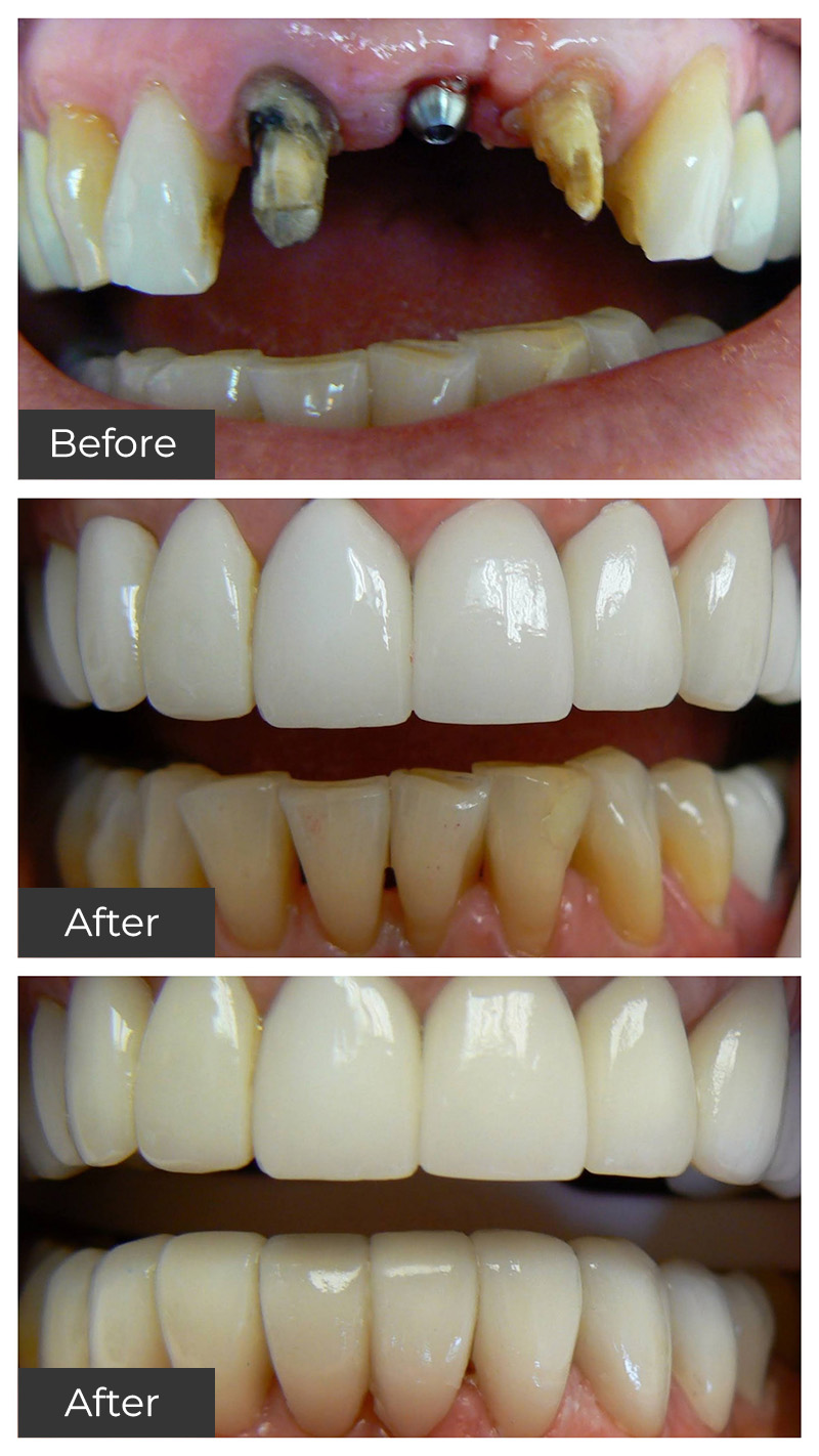 21st Century Dental Care | Botox reg , Preventive Care and Porcelain Dental Crowns