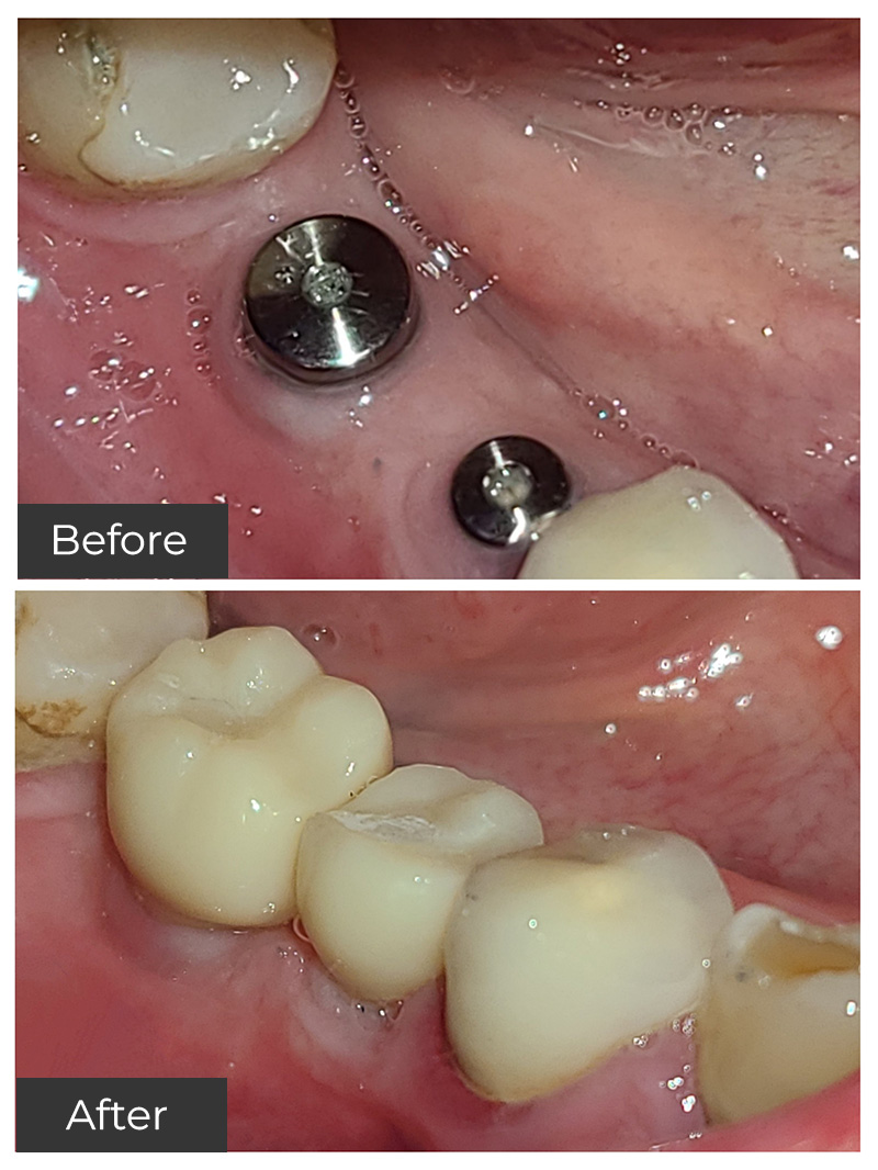 Juvederm in Basking Ridge