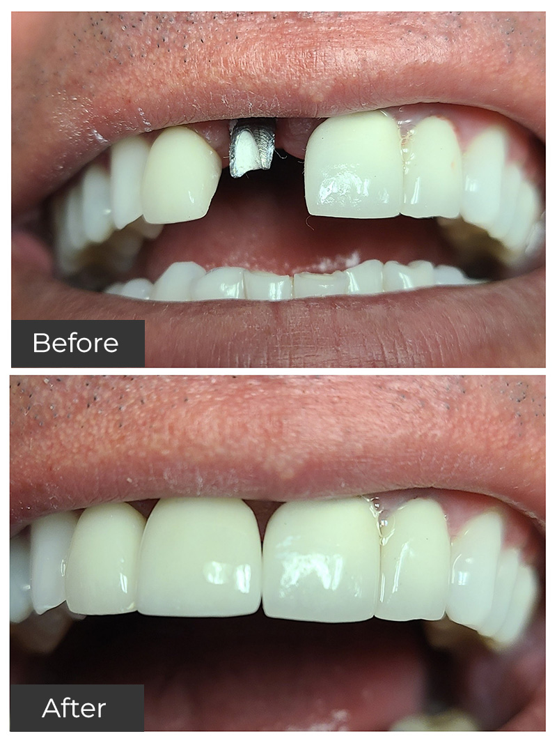 Cosmetic Dental Office Basking Ridge