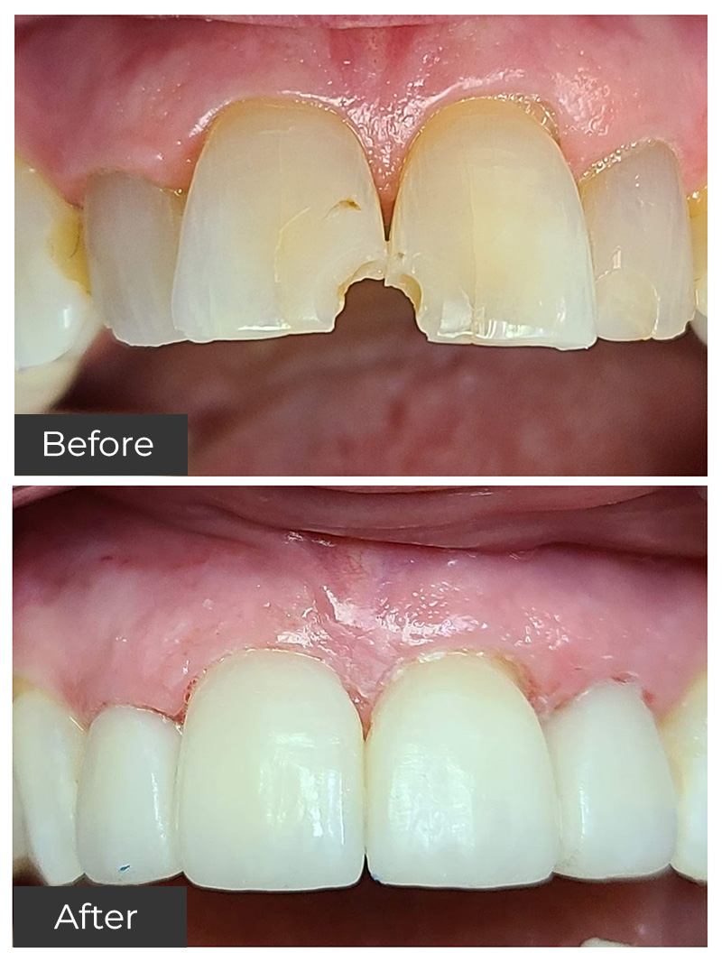 21st Century Dental Care | Dental Implants, Invisalign&reg; and Veneers