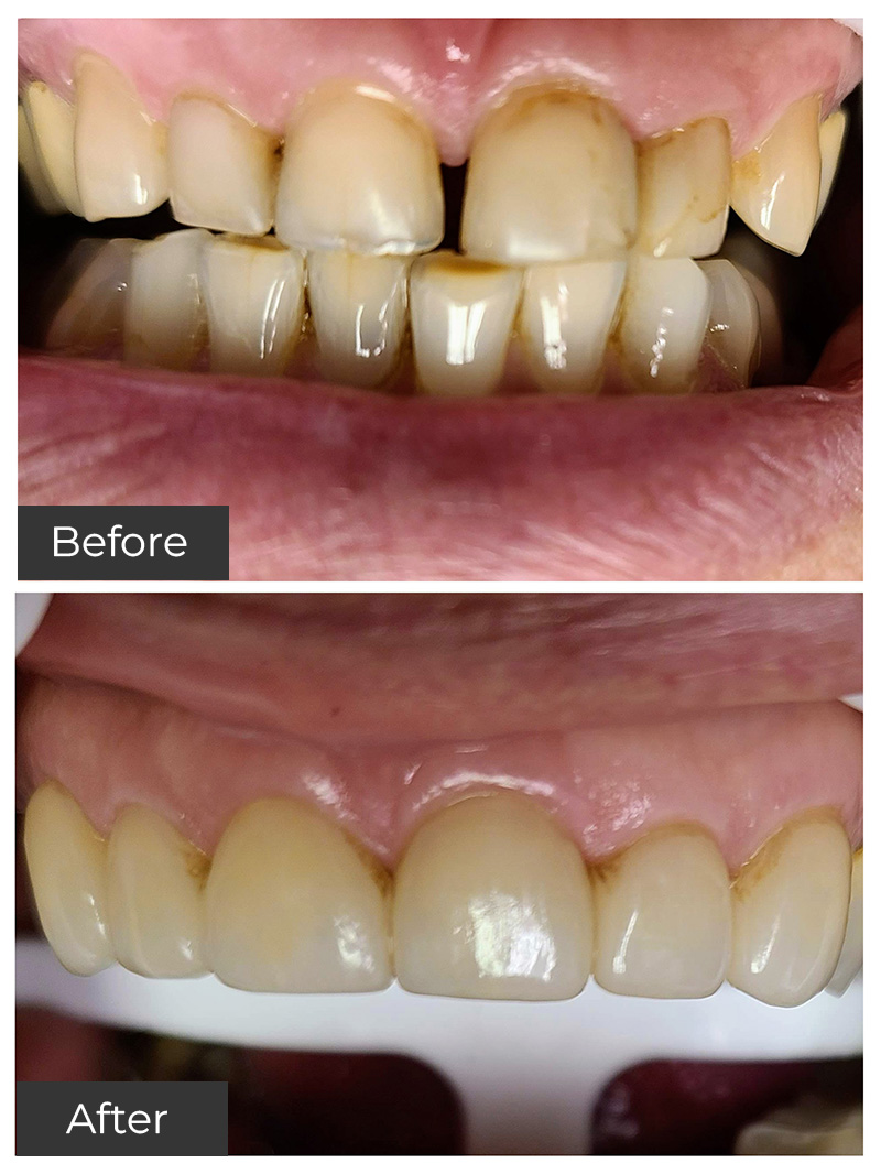 21st Century Dental Care | Teeth Whitening, Root Canal Treatment and Dental Fillings