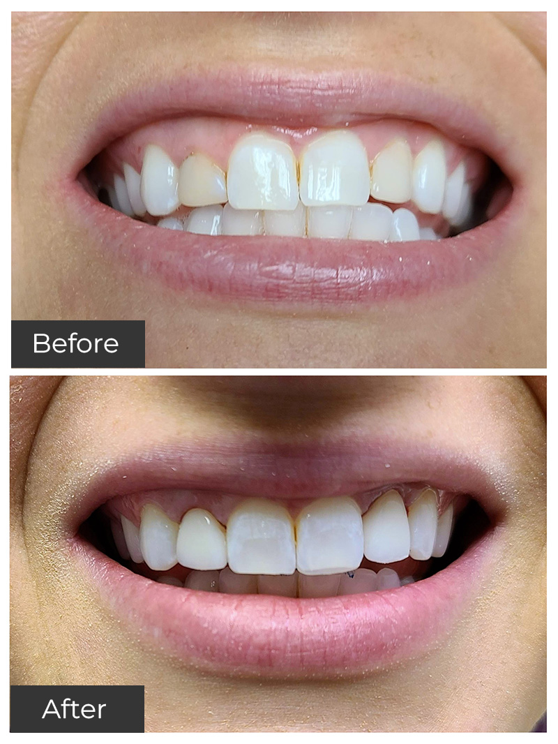 21st Century Dental Care | Preventive Care, Oral Surgery and Root Canal Treatment