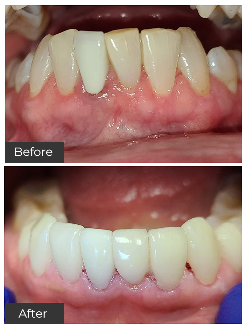 21st Century Dental Care | Dental Implants, Fixed Dental Bridges and TMJ Treatment