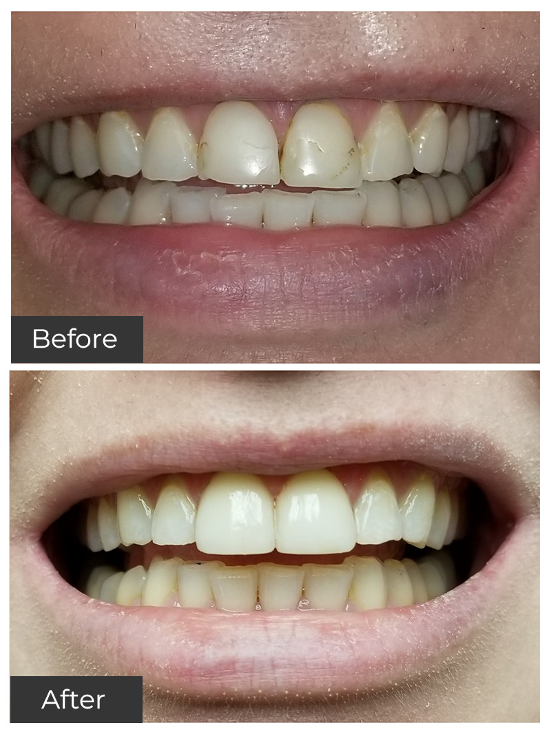 21st Century Dental Care | Oral Surgery, Teeth Whitening and Oral Sedation