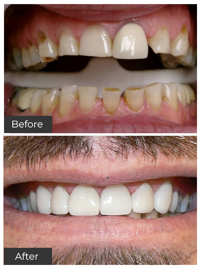 21st Century Dental Care | Invisalign&reg;, Botox&reg; and Oral Surgery