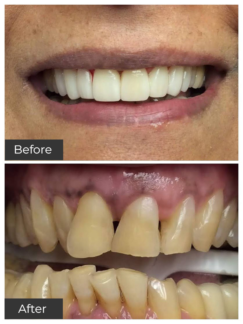 21st Century Dental Care | Oral Sedation, Periodontal Care and Botox&reg;