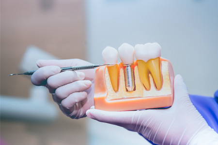 Basking Ridge Cosmetic Dentist